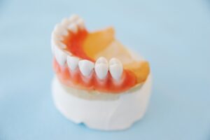 dental bridge