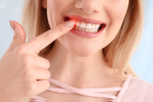 brighton periodontal disease
