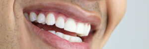 brighton dental implants