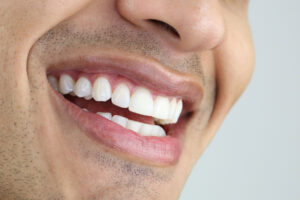 brighton dental implants