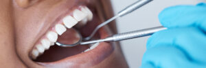 brighton root canal