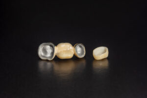 brighton dental crowns