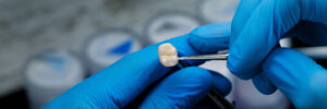 brighton dental crowns